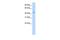 TRNA Nucleotidyl Transferase 1 antibody, GTX47307, GeneTex, Western Blot image 