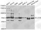 Clock Circadian Regulator antibody, A5633, ABclonal Technology, Western Blot image 