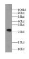 Syntaxin 8 antibody, FNab08456, FineTest, Western Blot image 