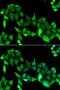 G protein-coupled receptor kinase 6 antibody, LS-C334672, Lifespan Biosciences, Immunofluorescence image 