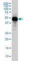 Serpin Family I Member 1 antibody, H00005274-M01, Novus Biologicals, Western Blot image 