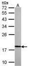 Visinin Like 1 antibody, PA5-30258, Invitrogen Antibodies, Western Blot image 