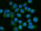 Acyl-CoA Synthetase Long Chain Family Member 4 antibody, M04372, Boster Biological Technology, Immunofluorescence image 