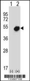 Nuclear Receptor Subfamily 0 Group B Member 1 antibody, 57-262, ProSci, Western Blot image 