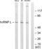 Heterogeneous Nuclear Ribonucleoprotein L antibody, GTX87723, GeneTex, Western Blot image 