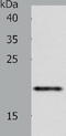 Zinc And Ring Finger 1 antibody, TA322144, Origene, Western Blot image 