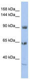 Two pore calcium channel protein 1 antibody, TA338582, Origene, Western Blot image 