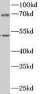 Carboxypeptidase N Subunit 1 antibody, FNab09983, FineTest, Western Blot image 