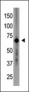Cryptochrome Circadian Regulator 1 antibody, 62-136, ProSci, Western Blot image 