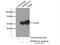 Alpha-1-antiproteinase antibody, 66135-1-Ig, Proteintech Group, Immunoprecipitation image 