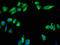 Actin Related Protein 2/3 Complex Subunit 1A antibody, LS-C672442, Lifespan Biosciences, Immunofluorescence image 