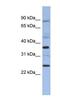 MAGE Family Member B3 antibody, NBP1-57659, Novus Biologicals, Western Blot image 