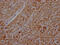 ATP Synthase F1 Subunit Beta antibody, CSB-RA216446A0HU, Cusabio, Immunohistochemistry paraffin image 