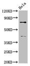 Dishevelled Segment Polarity Protein 2 antibody, LS-C375621, Lifespan Biosciences, Western Blot image 