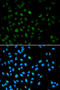 Enhancer Of Zeste 1 Polycomb Repressive Complex 2 Subunit antibody, STJ28381, St John