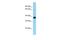 Snurportin 1 antibody, A07714, Boster Biological Technology, Western Blot image 