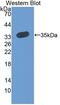 Regulator Of Calcineurin 2 antibody, LS-C373568, Lifespan Biosciences, Western Blot image 
