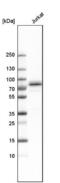 Thymocyte Selection Associated antibody, NBP1-90802, Novus Biologicals, Western Blot image 