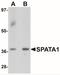 Spermatogenesis Associated 1 antibody, NBP2-41142, Novus Biologicals, Western Blot image 