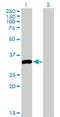 Serine/Threonine Kinase 16 antibody, H00008576-M03, Novus Biologicals, Western Blot image 