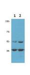 Cyclin Dependent Kinase 9 antibody, PA1-32113, Invitrogen Antibodies, Western Blot image 