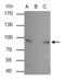 Junction Plakoglobin antibody, PA5-29930, Invitrogen Antibodies, Immunoprecipitation image 