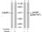 Vasodilator Stimulated Phosphoprotein antibody, GTX78924, GeneTex, Western Blot image 