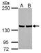 Leucine Rich Pentatricopeptide Repeat Containing antibody, GTX115351, GeneTex, Western Blot image 