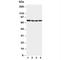 Interleukin 1 Receptor Associated Kinase 1 antibody, R31305, NSJ Bioreagents, Western Blot image 