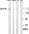 ATP Binding Cassette Subfamily C Member 12 antibody, LS-C120100, Lifespan Biosciences, Western Blot image 