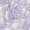 Sperm Acrosome Associated 1 antibody, PA5-60314, Invitrogen Antibodies, Immunohistochemistry frozen image 