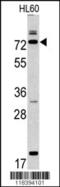 Calpain 9 antibody, 62-811, ProSci, Western Blot image 