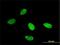 Lysine Demethylase 1A antibody, H00023028-M04, Novus Biologicals, Immunocytochemistry image 