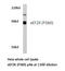 Eukaryotic Elongation Factor 2 Kinase antibody, LS-C176000, Lifespan Biosciences, Western Blot image 