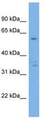 Ubiquilin 4 antibody, TA344809, Origene, Western Blot image 