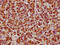 Heat Shock Protein Family B (Small) Member 1 antibody, CSB-RA010833A0HU, Cusabio, Immunohistochemistry frozen image 