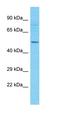 Transmembrane Protein 151A antibody, orb327125, Biorbyt, Western Blot image 