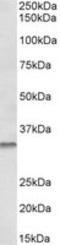 Caspase 6 antibody, TA320214, Origene, Western Blot image 