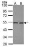 Cleavage And Polyadenylation Factor I Subunit 1 antibody, PA5-22386, Invitrogen Antibodies, Western Blot image 