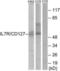 Interleukin 7 Receptor antibody, LS-C199116, Lifespan Biosciences, Western Blot image 