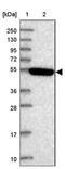 Serine/Threonine/Tyrosine Kinase 1 antibody, NBP2-13398, Novus Biologicals, Western Blot image 