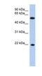 Crystallin Gamma C antibody, NBP1-52908, Novus Biologicals, Western Blot image 