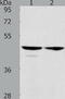 Actin Like 8 antibody, TA321909, Origene, Western Blot image 