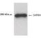 SNF2 Histone Linker PHD RING Helicase antibody, NB100-440, Novus Biologicals, Western Blot image 