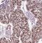 General Transcription Factor IIi antibody, FNab08630, FineTest, Immunohistochemistry frozen image 
