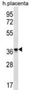 Olfactory Receptor Family 8 Subfamily D Member 4 antibody, abx026872, Abbexa, Western Blot image 