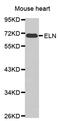 ELN antibody, PA5-76676, Invitrogen Antibodies, Western Blot image 