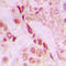 Parkinsonism Associated Deglycase antibody, LS-C353341, Lifespan Biosciences, Immunohistochemistry paraffin image 