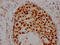 Histone Deacetylase 2 antibody, CSB-RA949799A0HU, Cusabio, Immunohistochemistry frozen image 