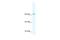 TLE Family Member 3, Transcriptional Corepressor antibody, A04315, Boster Biological Technology, Western Blot image 